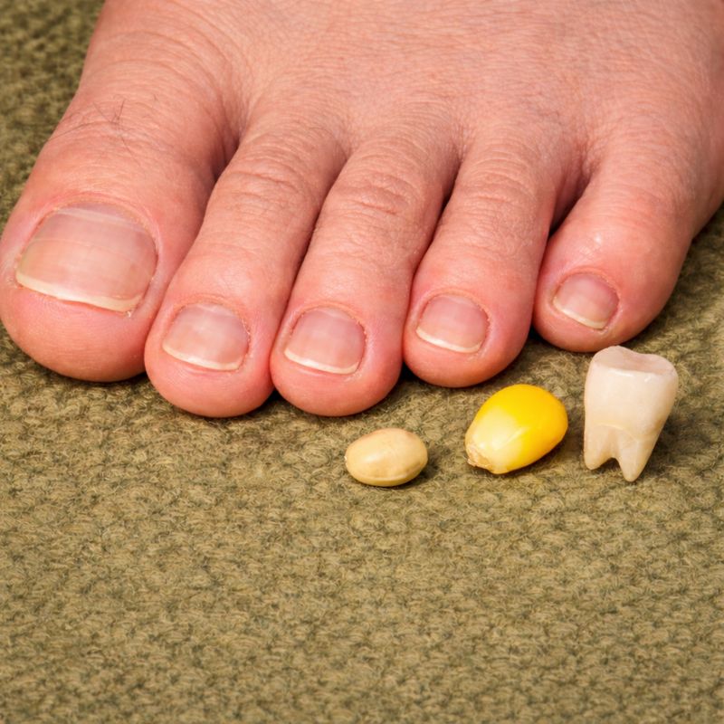 足の小指の爪の大きさを比較するため、足の小指の横に豆まきの大豆1粒、コーン1粒、前歯1本を並べた写真。小指の爪が豆やコーンより大きく、前歯とほぼ同じ大きさに見える。